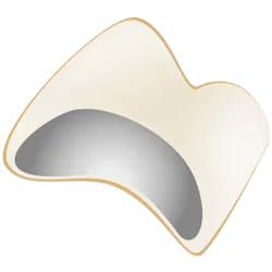 メタルボンドクラウン臼歯