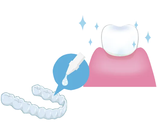 ホームホワイトニング