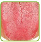 舌苔のない状態