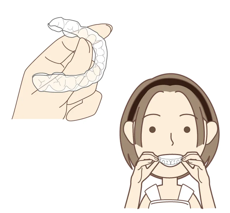 象牙質とエナメル質(歯の構造)