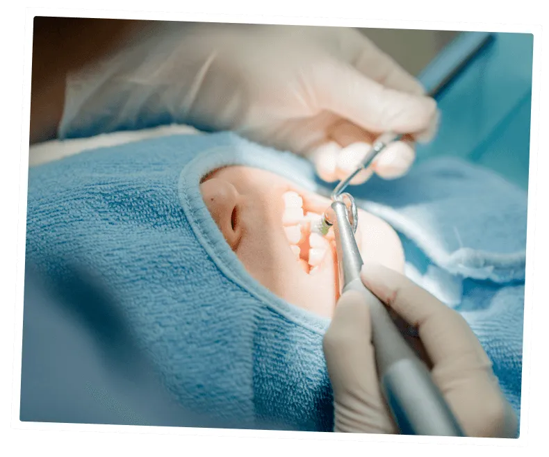 ホワイトニング