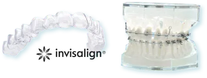 マウスピース矯正・プラケット矯正